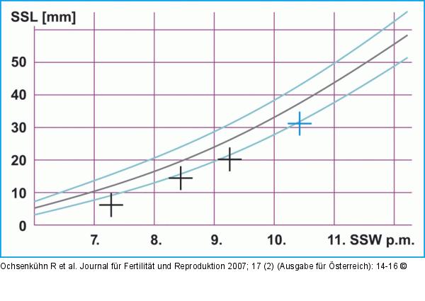 Biometrische Daten
