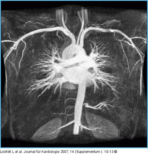 Magnetresonanzangiographie