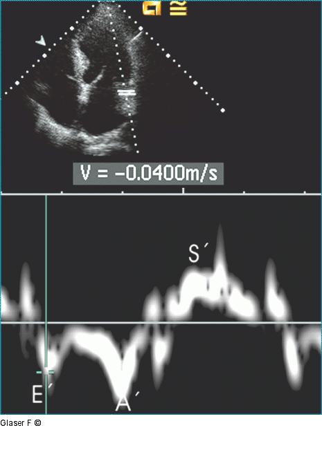 Gepulster Doppler