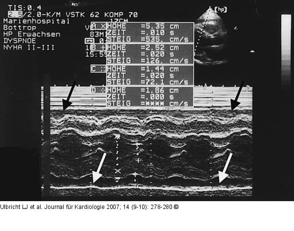 Echokardiographie