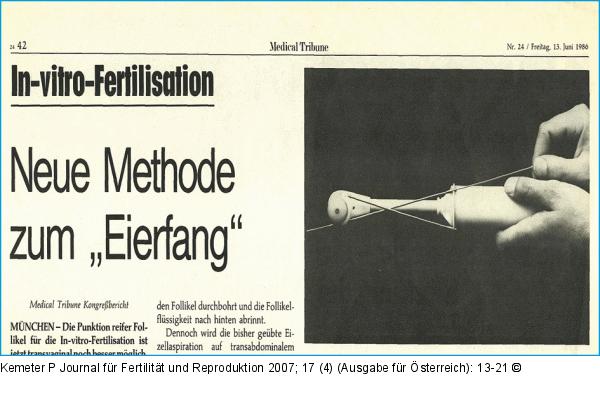 IVF