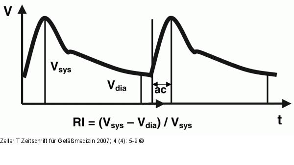 Intrarenales Doppler-Flußprofil