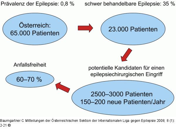 Epilepsiechirurgie
