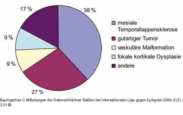 Epilepsiediagnostik - Epilepsiechirurgie