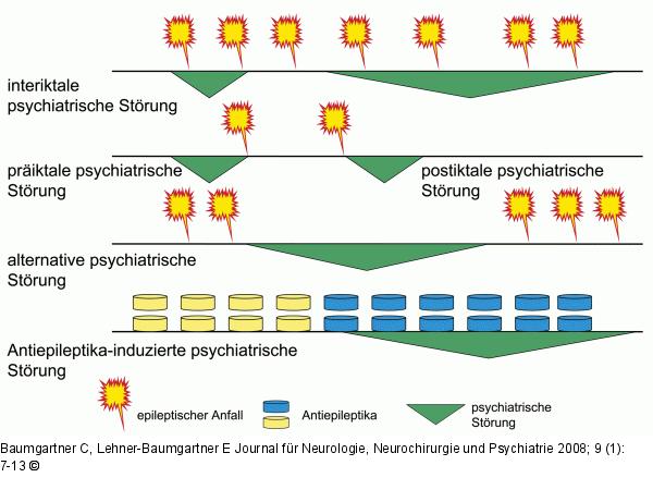 Psychiatrische Störung - Epileptischer Anfall