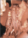Aktuelles Bild - Abb. 4: Trifurkationsprothese