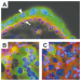 Abb. 2a-c: Human placenta