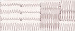 Abb. 1: EKG