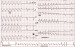 Abb. 14: BQRST