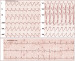 Abb. 16: VT