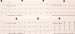 Aktuelles Bild - Abb. 2: EKG