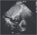 Aktuelles Bild - Abb. 17:  Vena cava inferior