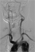 Abb. 3: Arcus aortae