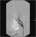 Abb. 13: Angiographie