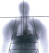 Aktuelles Bild - Abb. 1: Morbus Cushing
