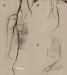 Abb. 2a-c: Arteria tib. posterior
