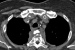 Abb. 1b: Mediastinum