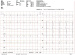 Abb. 1: EKG