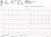 Abb. 2: EKG