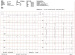 Abb. 6: EKG