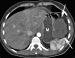 Abb. 1A: Hydro-MDCT