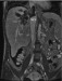 Abb. 2b: MR-Angiographie