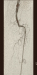 Aktuelles Bild - Abb. 10: Arteria femoralis - Verschluss