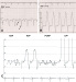 Abb. 1: PC- Invasive Hämodynamik