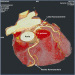 Abb. 1: Arteria coronaria