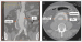 Abb. 1a-b: CT-Angiographie
