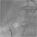 Abb. 2: Arterio-venöse Verbindung