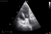 Abb. 1a: Echo