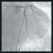 Abb. 4: Stent