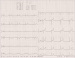 Aktuelles Bild - Abb. 2: EKG