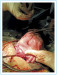 Aktuelles Bild - Abb. 2: Damage Control Surgery