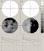 Abb. 1: Optikusneuritis