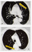 Abb. 2a-b: Nierentumor