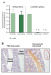 Abb. 4: Denosumab - Effekt