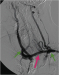 Abb. 2: Angiographie