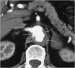 Abb. 1: Aorta