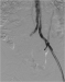 Abb. 3: Angiogramm
