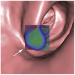 Abb. 1c: Translucency rendering