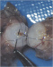 Abb. 2: Vasovasostomie