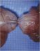 Abb. 3: Vasovasostomie