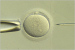 Abb. 9: ICSI