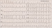 Aktuelles Bild - Abb. 1: EKG
