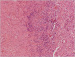 Aktuelles Bild - Abb. 3: Grand-mal-Anfall