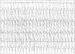 Abb. 1: EKG