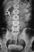 Abb. 1: Harntrakt - Tumor