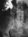 Abb. 3: Nephrostomie